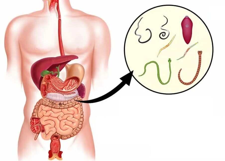 Vermixin çoğu helmint türüne yardımcı olur