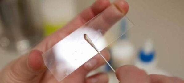 Solucan yumurtaları için kazıma